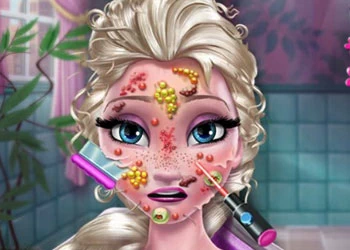 Ice Queen Skin Doctor στιγμιότυπο οθόνης παιχνιδιού