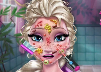 Ice Queen Skin Doctor скрыншот гульні