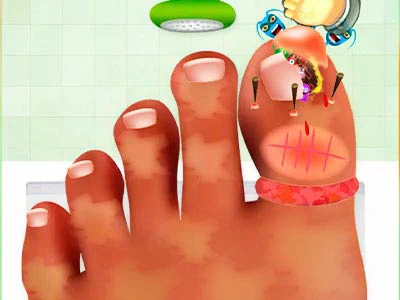 Gioco Di Chirurgia Delle Unghie screenshot del gioco